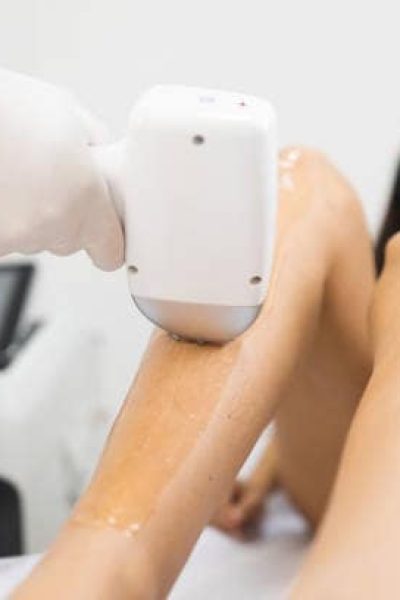 Laser hair removal from woman’s legs Laser hair removal from woman's legs