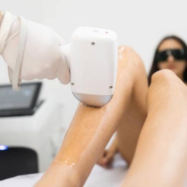 Laser hair removal from woman's legs